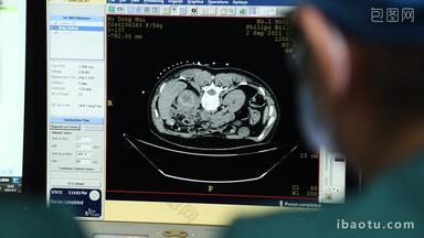 医学成像影像放射科CT